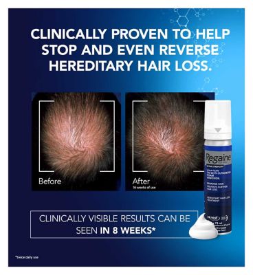 Regaine for Men Extra Strength Scalp Foam 5% w/w Cutaneous Foam - 1 months supply (3)