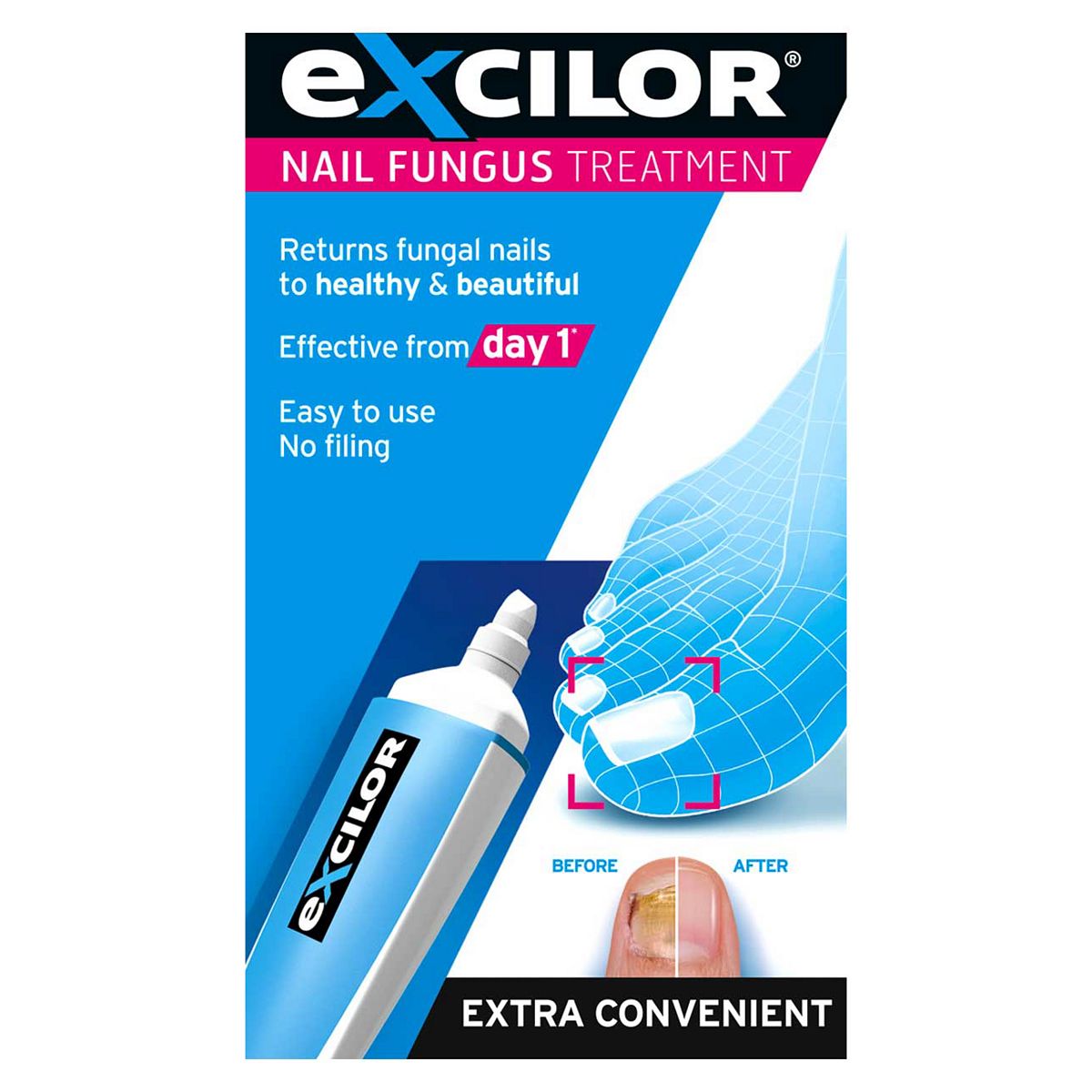 Excilor Fungal Nail Infection Pen