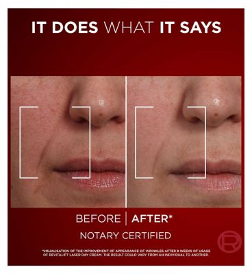 L’Oréal Paris Laser Renew Triple Action Anti-Ageing Day Cream, Visibly Reduce Fine Lines, 50ml (5)