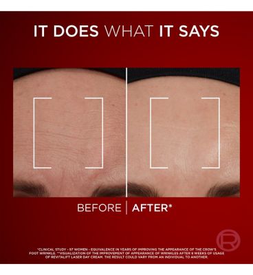 L’Oréal Paris Revitalift Laser Day Cream, Anti-Ageing SPF 25 Day Cream, [Pro-Retinol, Hyaluronic Acid + Vitamin C], 50ml (3)