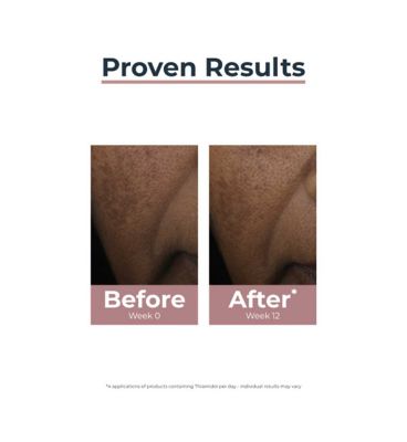 Anti-Pigment Spot Corrector (11)