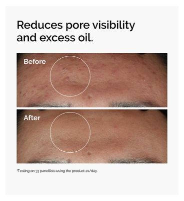 The Ordinary Niacinamide 10% + Zinc 1% Oil Control Serum - 30ml (4)