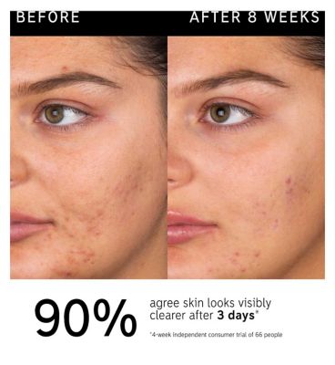 The INKEY List™ Salicylic Acid Cleanser 150ml (5)