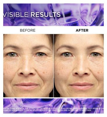 L'Oreal Paris Revitalift Filler Hyaluronic Acid Anti-Wrinkle Serum, 1.5% Pure Concentrated Micro-Epidermic Hyaluronic Acid, 30ml (3)