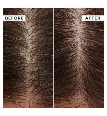 Philip Kingsley Flaky/Itchy Scalp Toner 250ml (23)