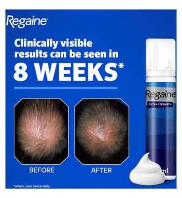 Regaine for Men Extra Strength Scalp Foam 5% w/w Cutaneous Foam - 3 Months Supply (8)