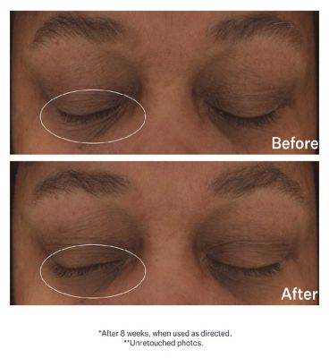 StriVectin Hyaluronic Tripeptide Gel-Cream for Eyes (3)