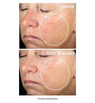 StriVectin Super-C Retinol Brightening & Correcting Serum (2)