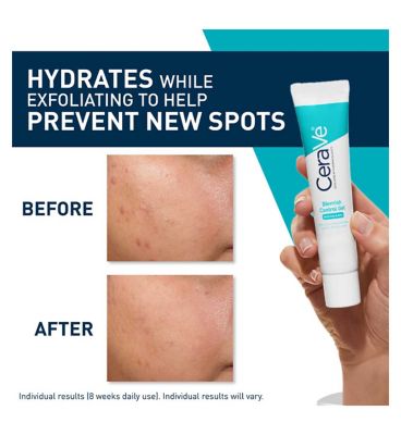 CeraVe Blemish Control Gel Moisturiser with 2% Salicylic Acid & Niacinamide for Blemish-Prone Skin 40ml (11)