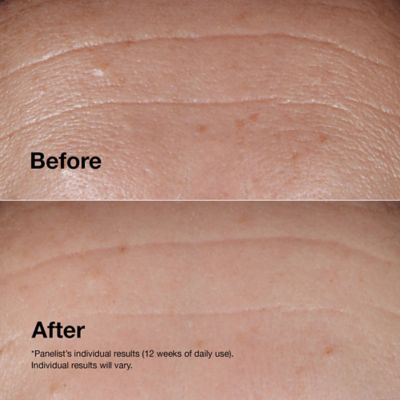 Clinique Smart Clinical Repair™ Wrinkle Correcting Serum 100ml (6)