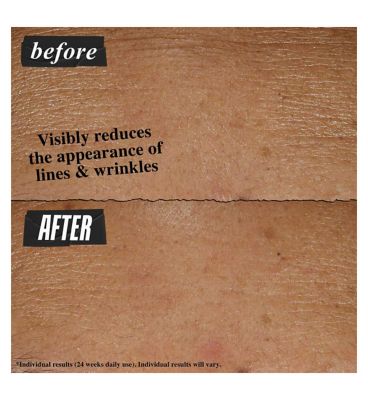 Kiehl's Retinol Skin-Renewing Daily Micro-Dose Serum 30ml (8)