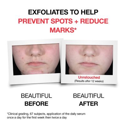 Neutrogena Clear and Defend+ Wash 200ml (4)