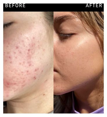 The INKEY List™ Niacinamide Serum 30ml (8)