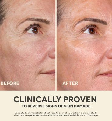 No7 Future Renew Serum 50ml (9)