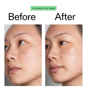 Hyaluronic Acid Serum - 30ml (7)