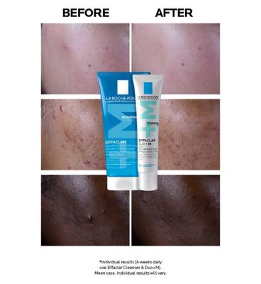 La Roche-Posay Effaclar Duo+M: Anti-Breakout Corrective Gel Moisturiser 40ml (2)