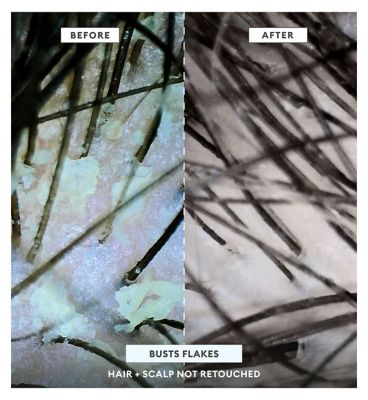 Briogeo MegaStrength+ Dandruff Control Shampoo Charcoal + AHA/BHA with Salicylic Acid 3% 248ml (5)