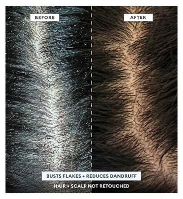 Briogeo MegaStrength+ Dandruff Control Shampoo Charcoal + AHA/BHA with Salicylic Acid 3% 248ml (7)