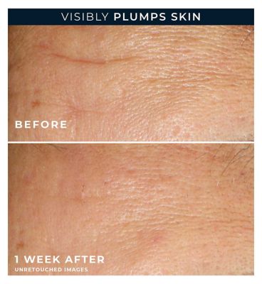 RoC Multi Correxion Hydrate + Plump Serum Capsules with Hyaluronic Acid, 10.5ml- 30 Capsules (9)