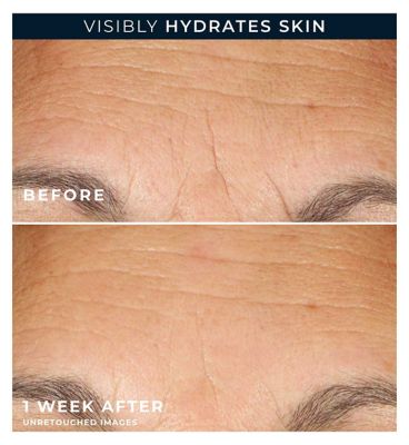 RoC Multi Correxion Hydrate + Plump Serum Capsules with Hyaluronic Acid, 10.5ml- 30 Capsules (10)