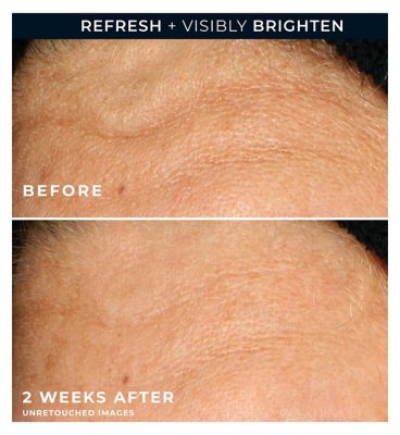 RoC Multi Correxion Revive + Glow Vitamin C Gel Cleanser to Boost Skin Radiance 177ml (10)