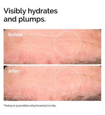 The Ordinary Hyaluronic Acid 2% + B5 Hydrating Serum - 60ml (15)