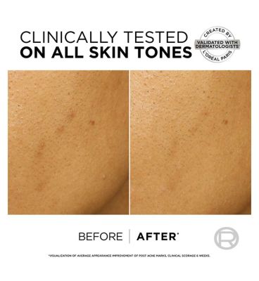 L'Oréal Paris Bright Reveal Dark Spot Exfoliant Peel 25% AHA + BHA + PHA and Niacinamide 25ml (4)