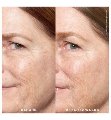 Ole Henriksen Double Rewind 0.3% Pro-Grade Retinol Serum 30ml (4)