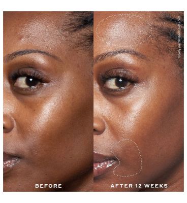 Ole Henriksen Double Rewind 0.3% Pro-Grade Retinol Serum 30ml (5)