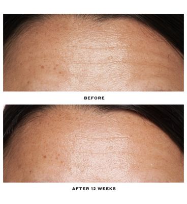 Ole Henriksen Double Rewind 0.3% Pro-Grade Retinol Serum 30ml (6)