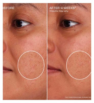 The POREfessional (127)