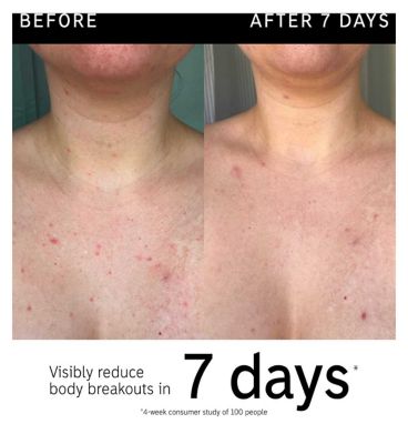 The INKEY List Glycolic Acid Exfoliating Body Stick (7)