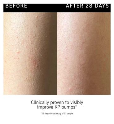 The INKEY List Glycolic Acid Exfoliating Body Stick (8)