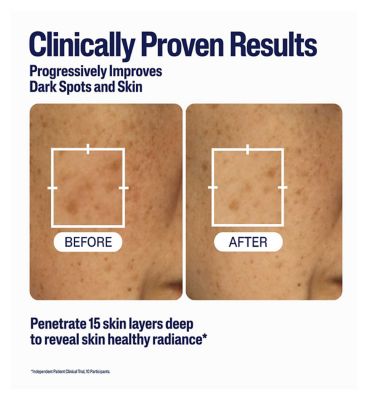 Cetaphil Healthy Radiance Brightening Serum with Niacinamide for Dark Spots, 30ml (5)