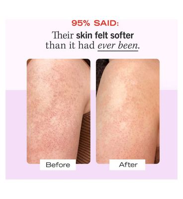 First Aid Beauty KP Smoothing Body Scrub with 10% AHA 226g (4)