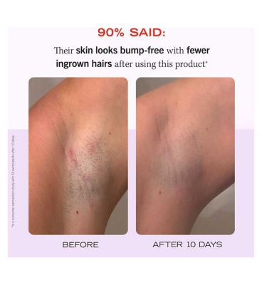 First Aid Beauty Ingrown Hair Pads with BHA&AHA 28 Pads (15)