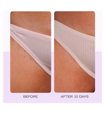 First Aid Beauty Ingrown Hair Pads with BHA&AHA 28 Pads (17)