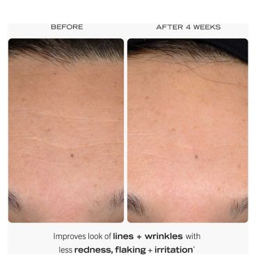 First Aid Beauty 0.3% Retinol Complex Serum with Peptides 30ml (3)