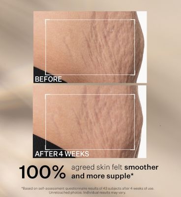 StriVectin SD Advanced Plus Intensive Moisturizer 60ml (6)