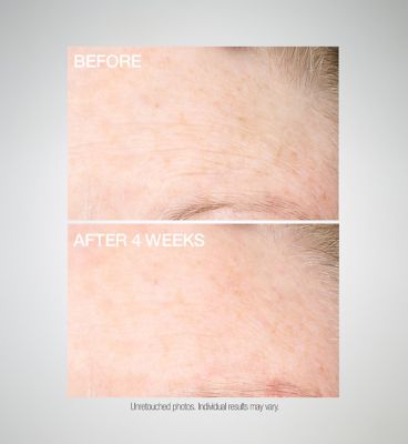 Strivectin SD Advanced PLUS Intensive Moisturizer 118ml (3)