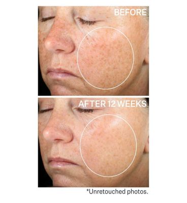 StriVectin Super-C Retinol Brighten & Correct Vitamin C Serum (6)