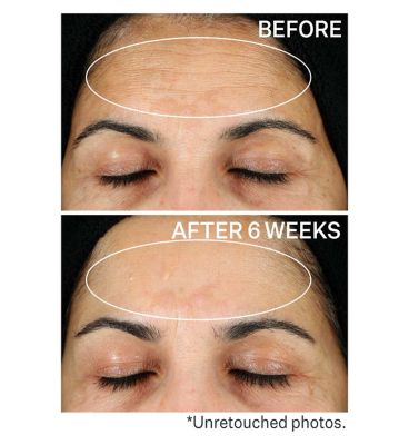 StriVectin Super-C Retinol Brighten & Correct Vitamin C Serum (8)