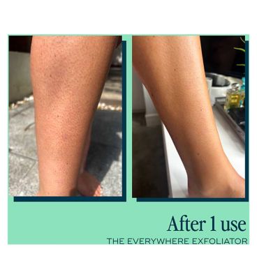 Luna Daily The Everywhere Exfoliator with AHAs for Keratosis Pilaris, Ingrowns & Smoother Skin 180ml (40)