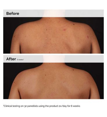 The Ordinary Salicylic Acid 0.5% Body Serum (7)