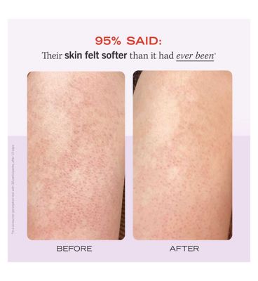 First Aid Beauty KP Bump Eraser Body Scrub 10% AHA - Fresh Strawberry 226g (16)