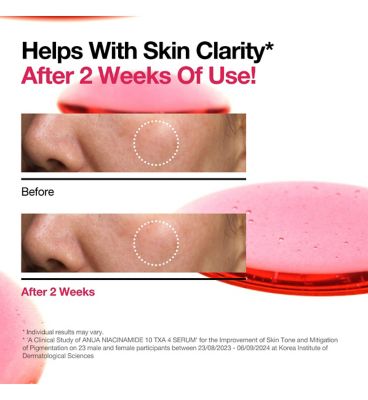 Anua Niacinamide 10% and TXA 4% Serum 30ml (11)
