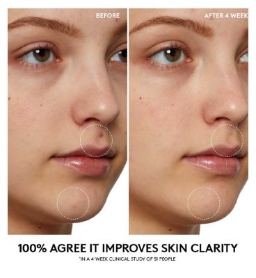 Fenty Skin Cherry Dub Pore Purify’r Gel Cleanser 190ml (7)