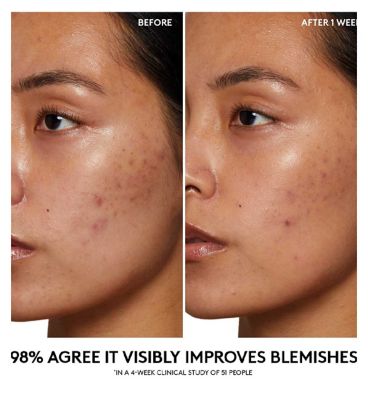 Fenty Skin Cherry Dub Pore Purify’r Gel Cleanser 190ml (8)