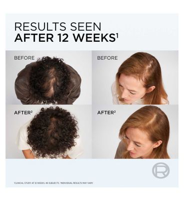 Elvive growth-booster-anti-hair-loss-shampoo (7)