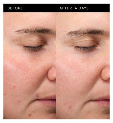 The Inkey List Exosome Hydro-Glow Complex 30ml (5)